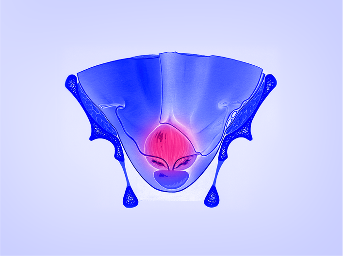 prostate1.png