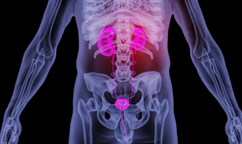 kidney cancer.png