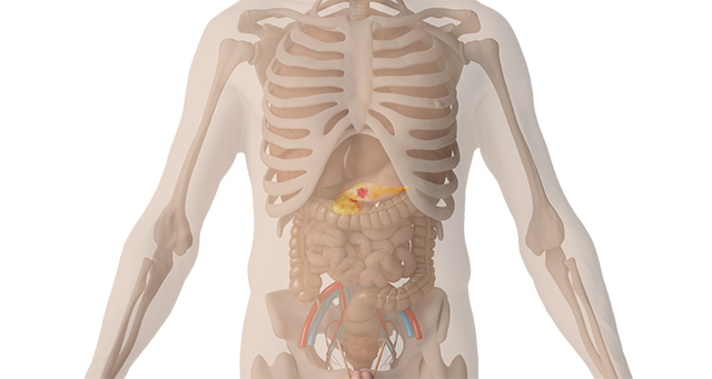 Gastrointestinal Tract Tumor.png